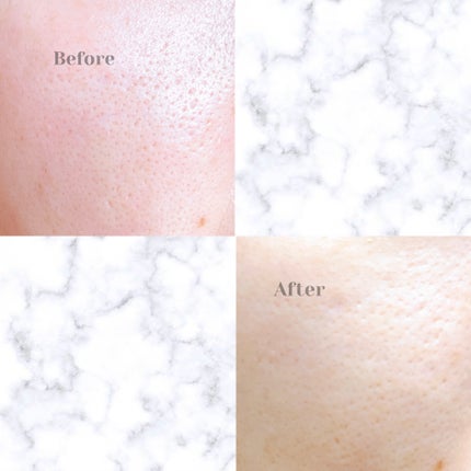 CICA デイリースージングマスク/VT/シートマスク・パックを使ったクチコミ(5枚目)