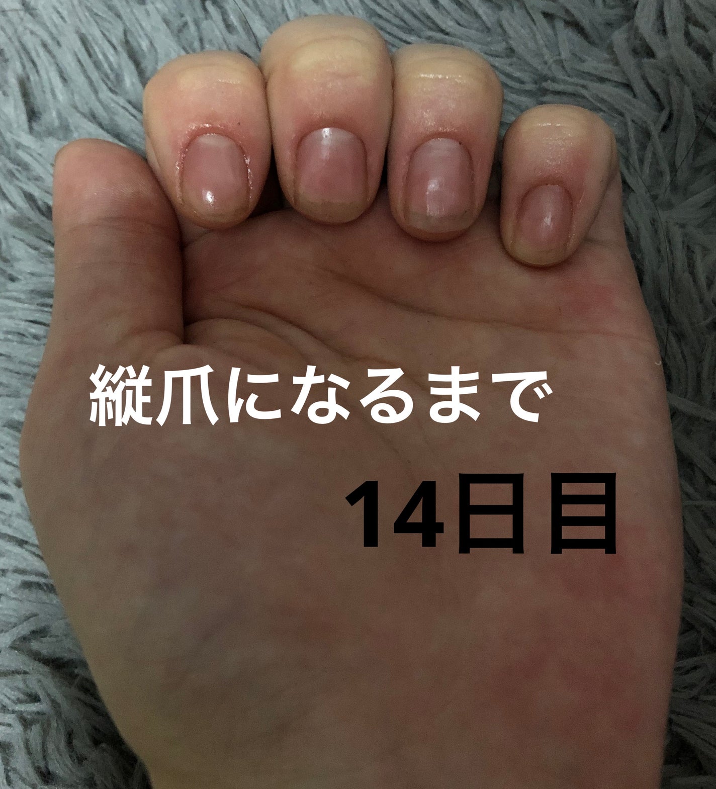 ð on LIPS ã瞊çªã«ãªãããã«ãããããªæ¹æ³ããã£ããæããŠãã ããð#çª_..ãïŒ1æç®ïŒ