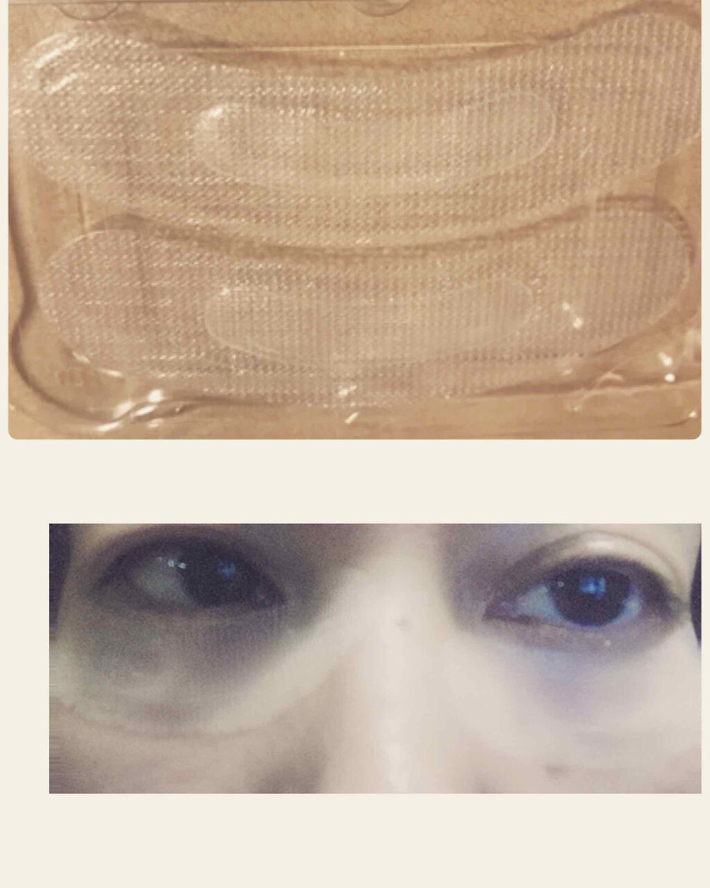 ナチュラベーレ THEマイクロニードル/ナチュラベーレ/シートマスク・パックを使ったクチコミ(2枚目)