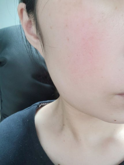 バイオ コンディショニング エッセンス/IOPE/ブースター・導入液を使ったクチコミ(6枚目)