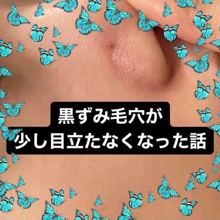 潤浸保湿 フェイスクリーム/キュレル/フェイスクリームを使ったクチコミ(1枚目)
