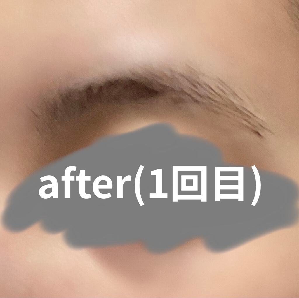 脱色クリーム 敏感肌用/エピラット/ムダ毛ケアを使ったクチコミ(4枚目)