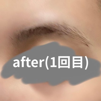 脱色クリーム 敏感肌用/エピラット/ムダ毛ケアを使ったクチコミ(4枚目)