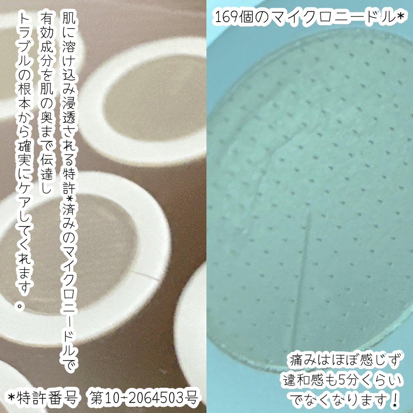 エーキュアショットスポットパッチ/obsero/にきびパッチを使ったクチコミ(2枚目)