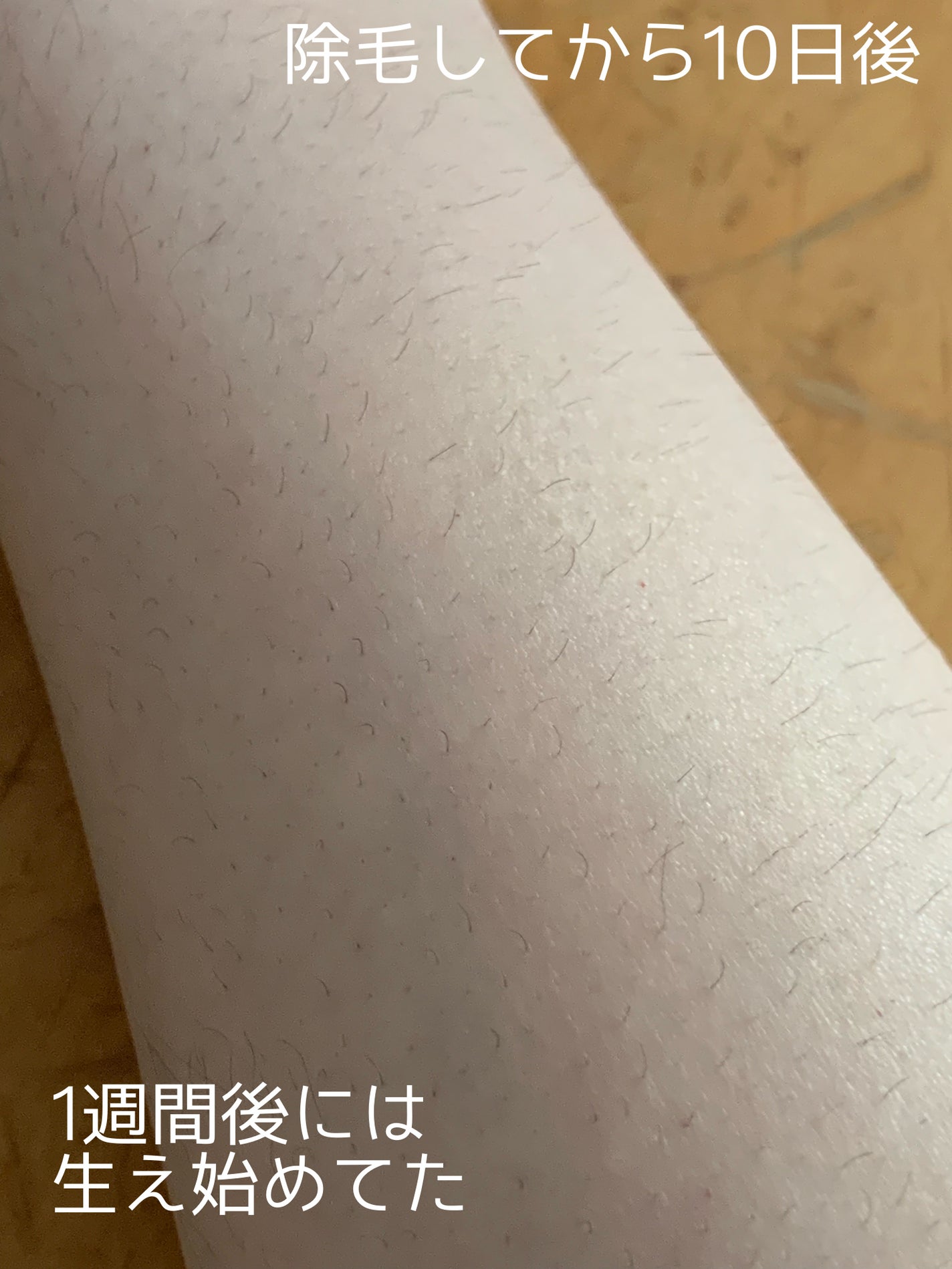 ヴィート ピュアボタニカルズ 除毛クリーム/Veet/除毛クリームを使ったクチコミ(5枚目)