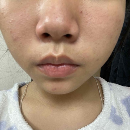 明色美顔水 薬用化粧水/美顔/化粧水を使ったクチコミ(3枚目)