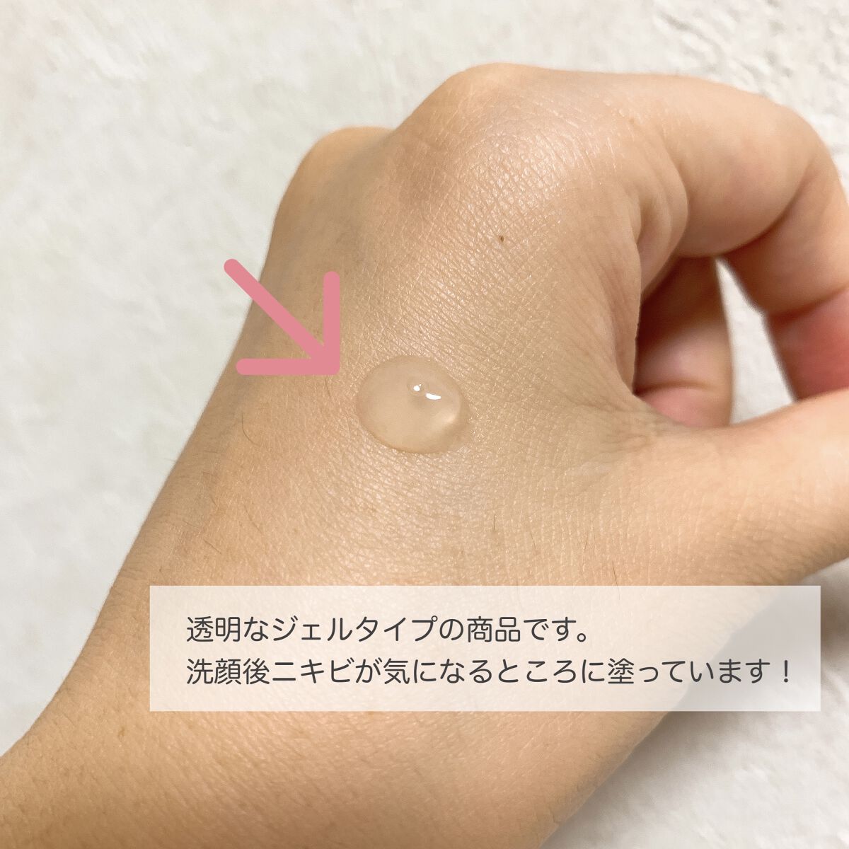 薬用3ステップセット30日サイズ/プロアクティブ/トライアルキットを使ったクチコミ（3枚目）