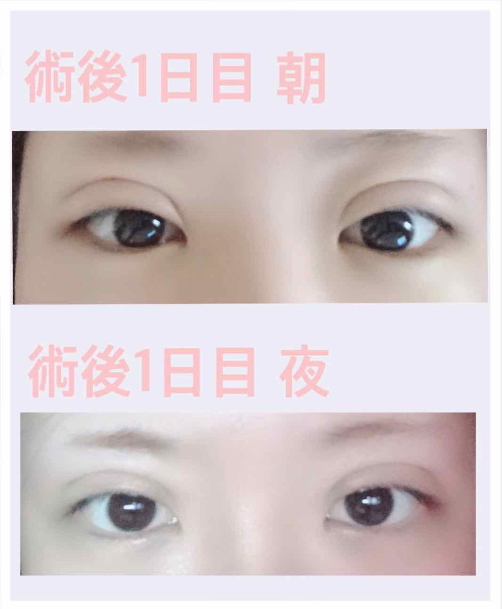 momo on LIPS ãðåæ²¡4ç¹çãðååã®æçš¿ã«åŒãç¶ããç¿æ¥ã®æ§åð€è
«ãæ¹ã¯ããŸ..ãïŒ1æç®ïŒ