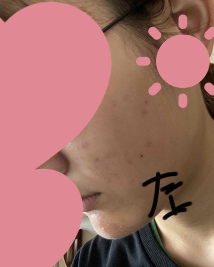 クリアトライアルセット M(しっとりタイプ)/オルビス/トライアルキットを使ったクチコミ(2枚目)