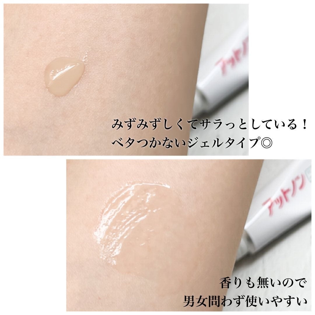 ニキビあとケアジェル/アットノン/その他スキンケアを使ったクチコミ(3枚目)