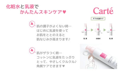 モイスチュア ローション/カルテHD/化粧水を使ったクチコミ(1枚目)