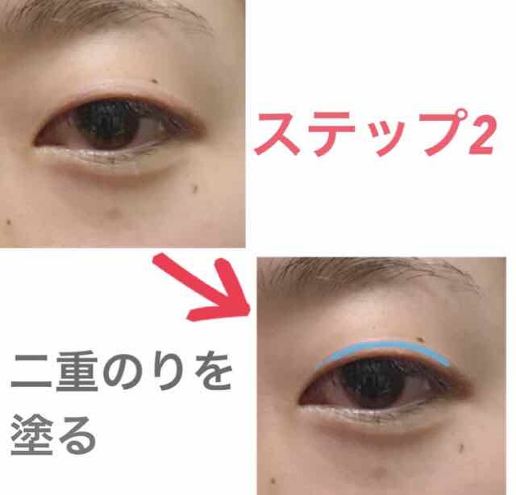 ワンダーアイリッドテープ リタッチボンド/D-UP/二重まぶた用アイテムを使ったクチコミ（2枚目）