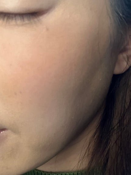 ブロッサムブラッシュ #ANEMONE/CILY/パウダーチークの画像