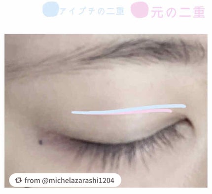 アイトーク/アイトーク/二重まぶた用アイテムを使ったクチコミ(2枚目)