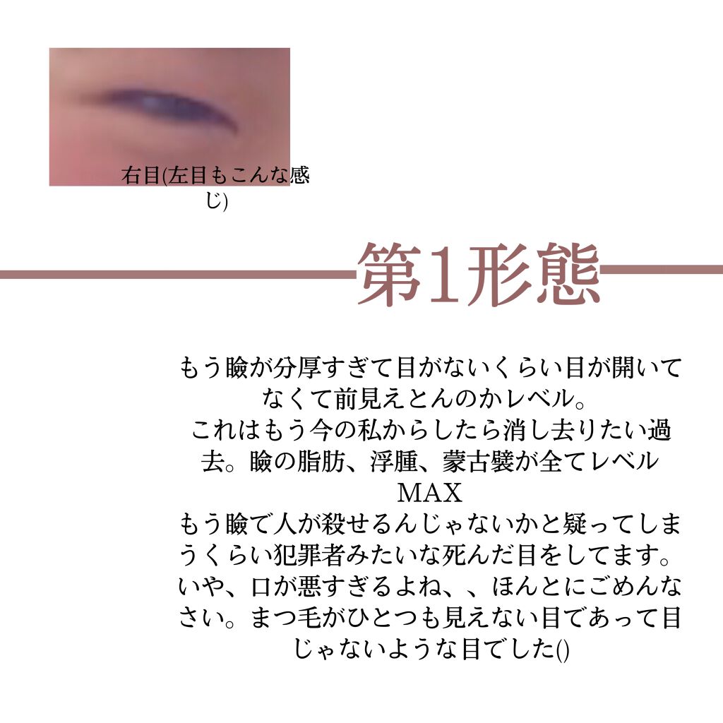 オリシキ アイリッドスキンフィルム		/D-UP/二重まぶた用アイテムを使ったクチコミ（2枚目）