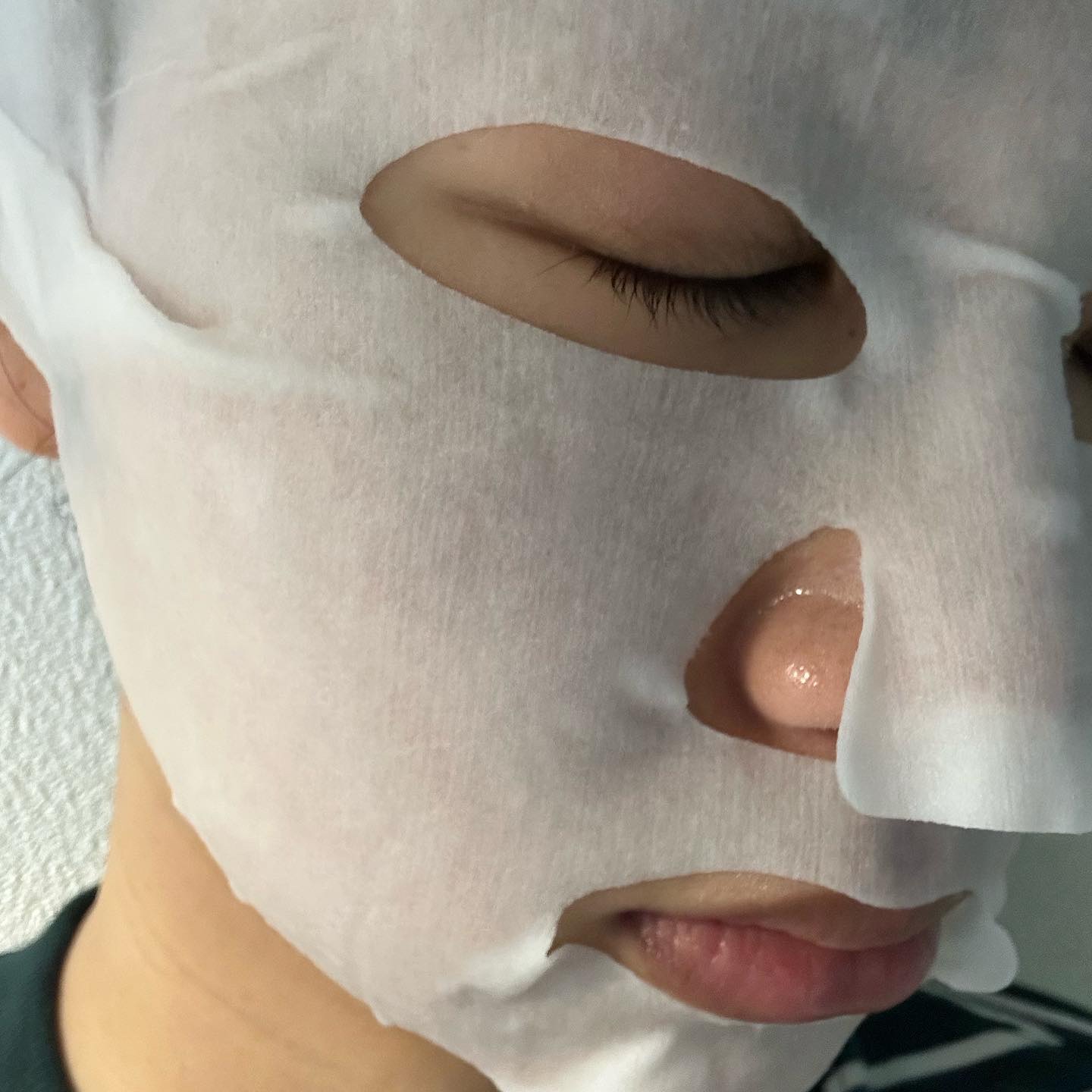 ダーマレーザースペクター ウルセラCMAX/クオリティファースト/美容液を使ったクチコミ（3枚目）