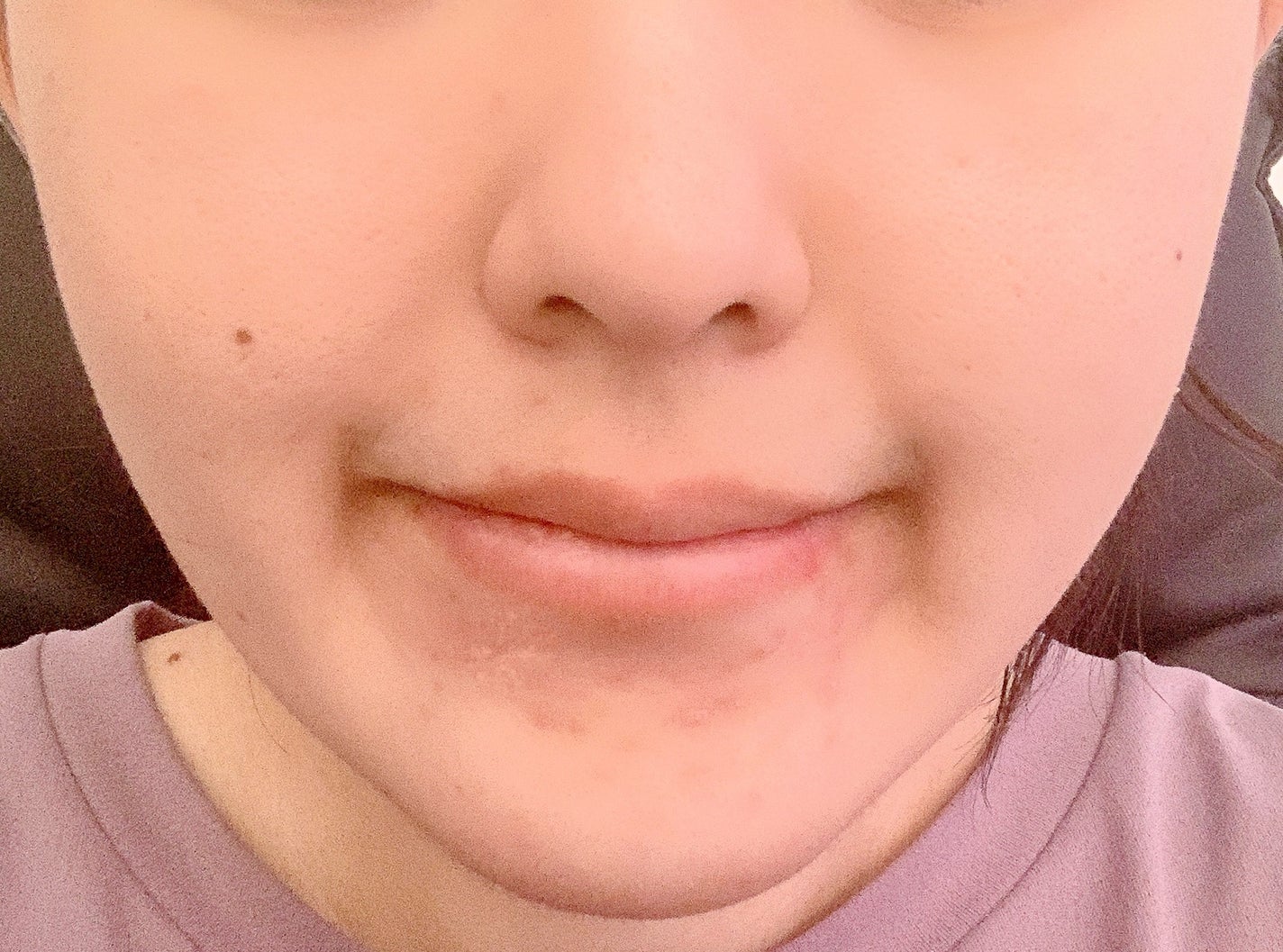 ピーディーアールエヌエッセンス PDRN 100/VT/美容液を使ったクチコミ(3枚目)