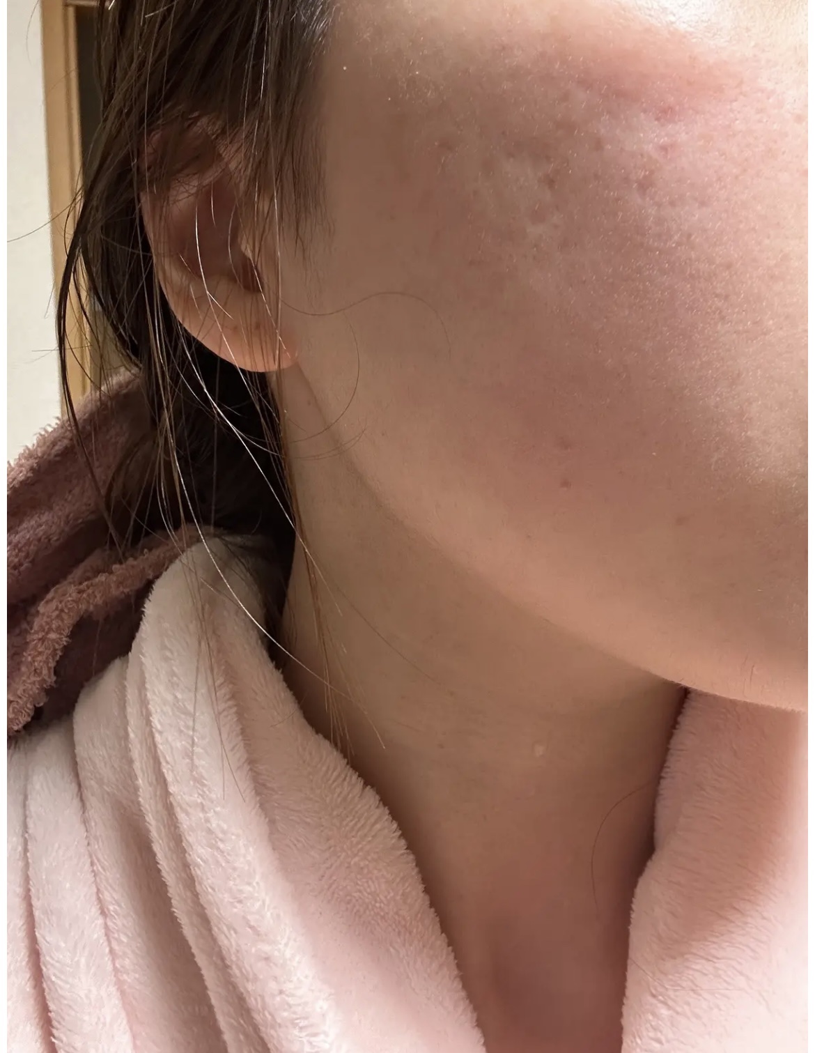 どんぐり ポア ペプチド パッド/SKINFOOD/トナーパッドを使ったクチコミ（1枚目）