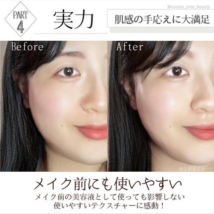 マイクロバブルVCセラム/DSW/美容液を使ったクチコミ(6枚目)