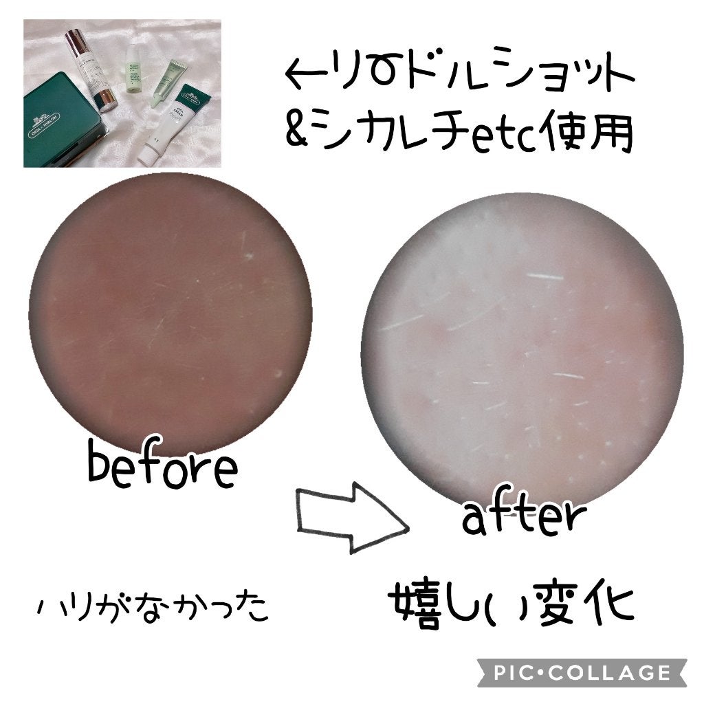 シカレチA エッセンス0.1/VT/美容液を使ったクチコミ(2枚目)