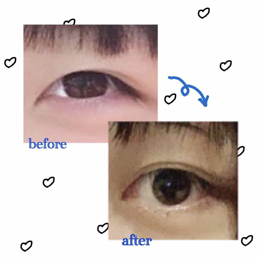 ð·ð ð ððž on LIPS ããã®ç»åã¯äžåŠ3幎çã®ç§ãšçŸåš(髿 ¡2幎ç)ã®ç§ã®ç®ã®åçã§ã..ãïŒ2æç®ïŒ