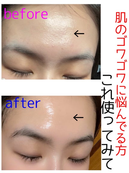 クラリファイング ローション 2/CLINIQUE/拭き取り化粧水を使ったクチコミ(1枚目)