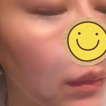 メディリフト 3Dマイクロフィラー(口元用)/YA-MAN TOKYO JAPAN/シートマスク・パックを使ったクチコミ(5枚目)