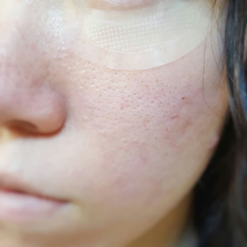 シロバリモイストパッチ/sirobari/シートマスク・パックを使ったクチコミ(4枚目)