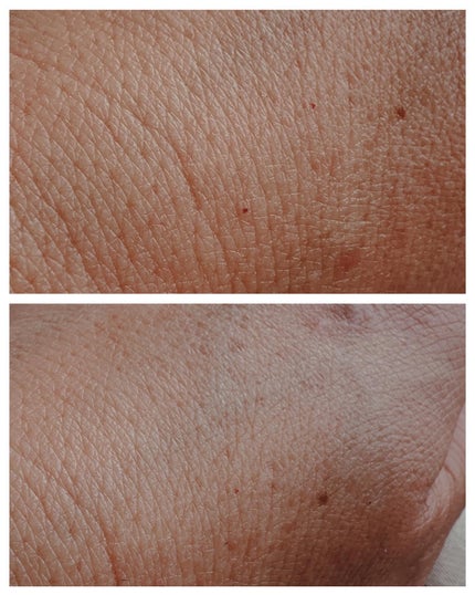 ザモイスチャーバリアDリキッドトナー/Dr.G/化粧水を使ったクチコミ(4枚目)