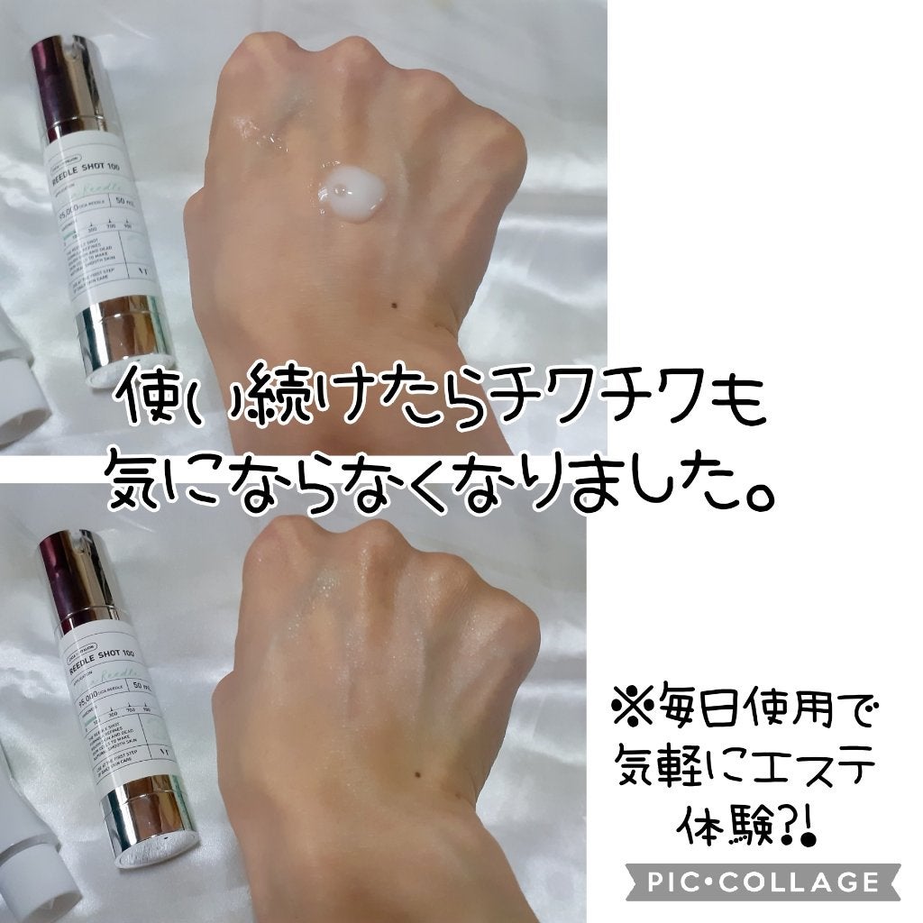 シカレチA エッセンス0.1/VT/美容液を使ったクチコミ(5枚目)