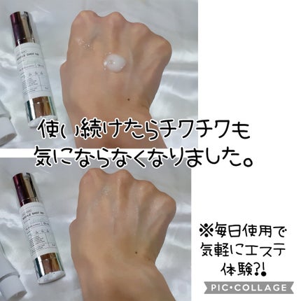 シカレチA エッセンス0.1/VT/美容液を使ったクチコミ(5枚目)