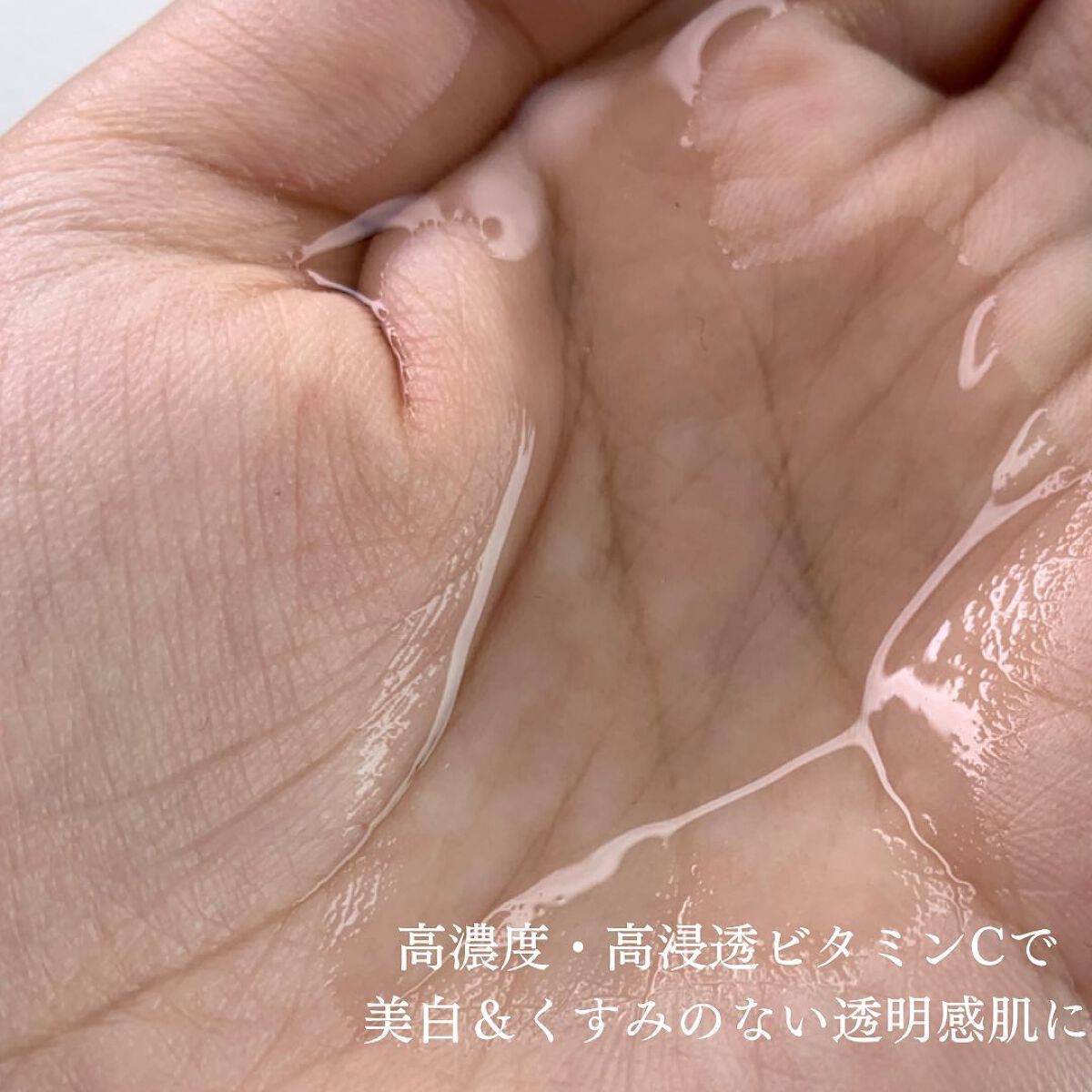 VC100エッセンスローション EX/ドクターシーラボⓇ/化粧水を使ったクチコミ（3枚目）