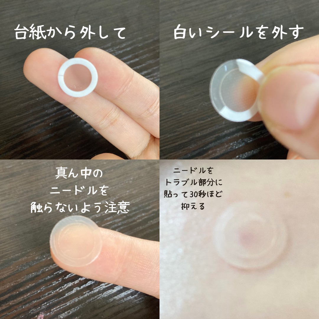 エーキュアショットスポットパッチ/obsero/にきびパッチを使ったクチコミ(3枚目)