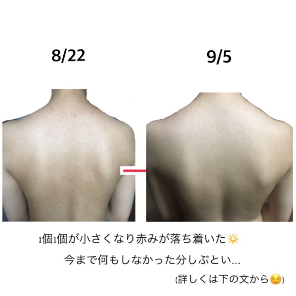 セナキュア(医薬品)/小林製薬/その他を使ったクチコミ(2枚目)