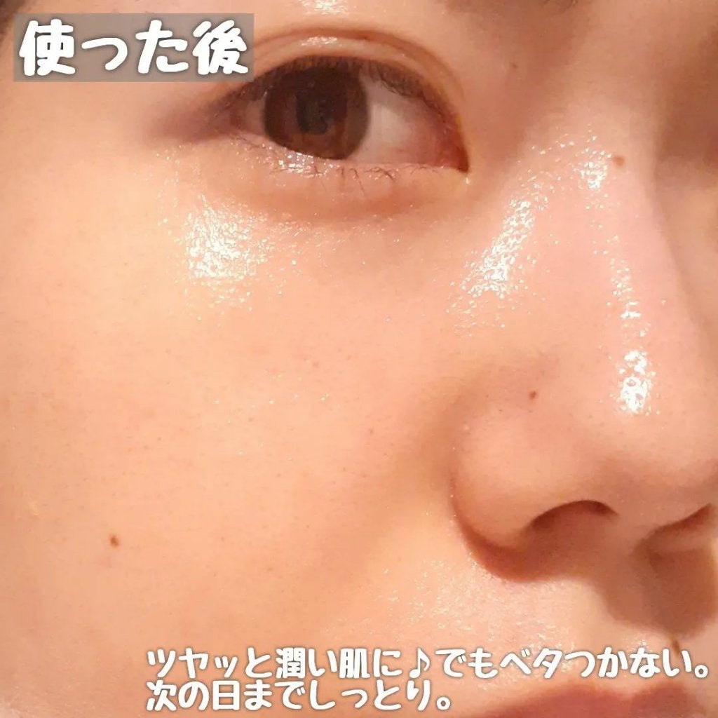 CUREPAIR MELA CREAM /KOPHER/フェイスクリームを使ったクチコミ(7枚目)