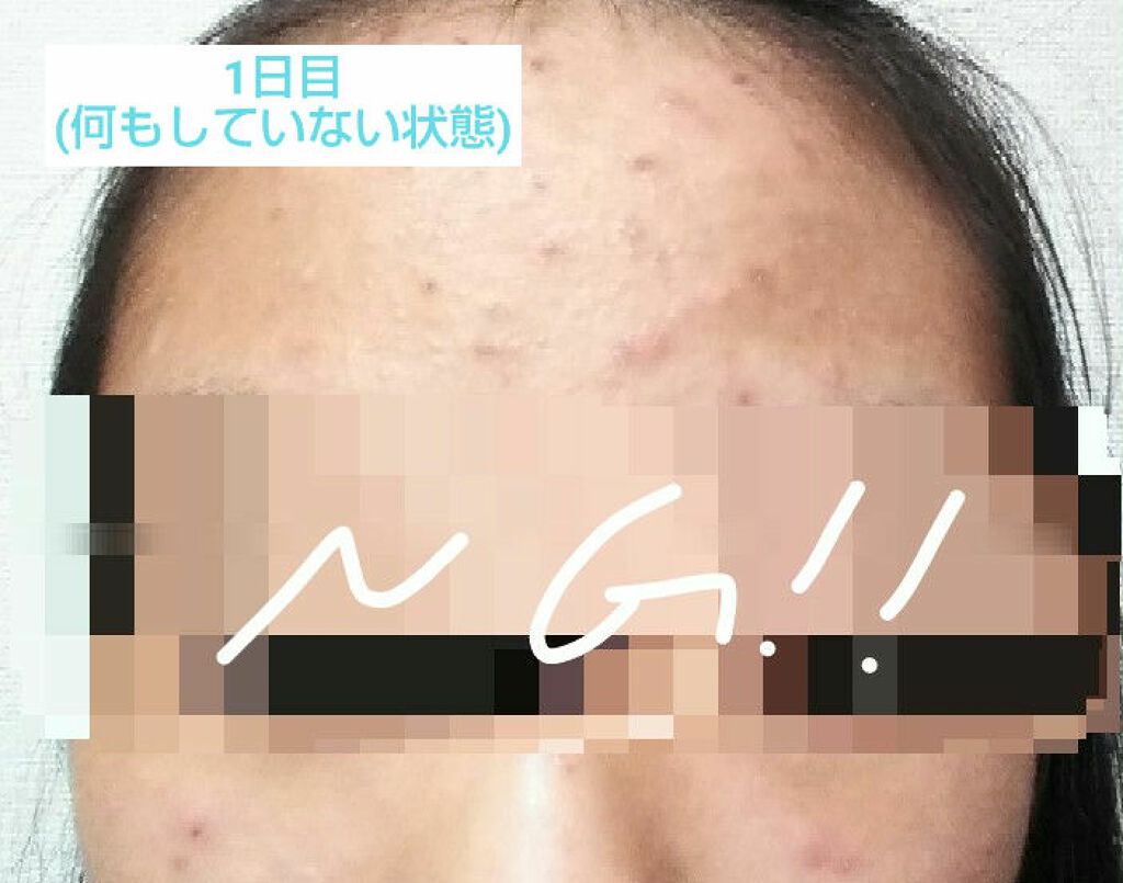 しっとりピーリング/毛穴撫子/ピーリングを使ったクチコミ（2枚目）