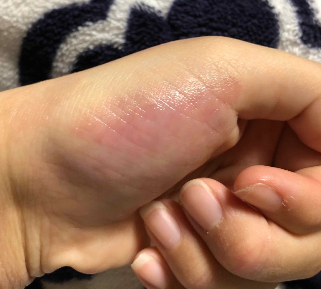 リップ＆チーク ジェル/キャンメイク/ジェル・クリームチークを使ったクチコミ（1枚目）