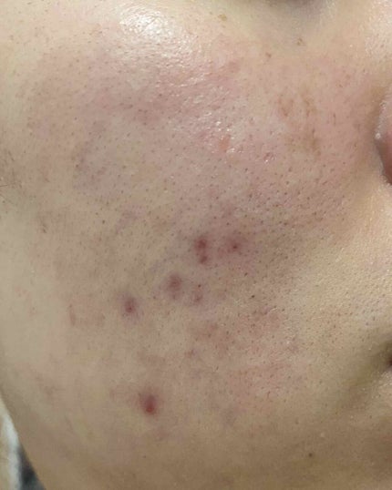 ハトムギ洗顔フォーム/株式会社イヴ/洗顔フォームを使ったクチコミ(2枚目)