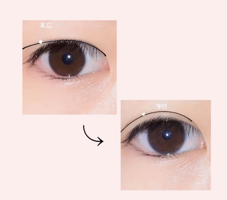 肌色タイプ/バンドエイド/その他を使ったクチコミ（2枚目）