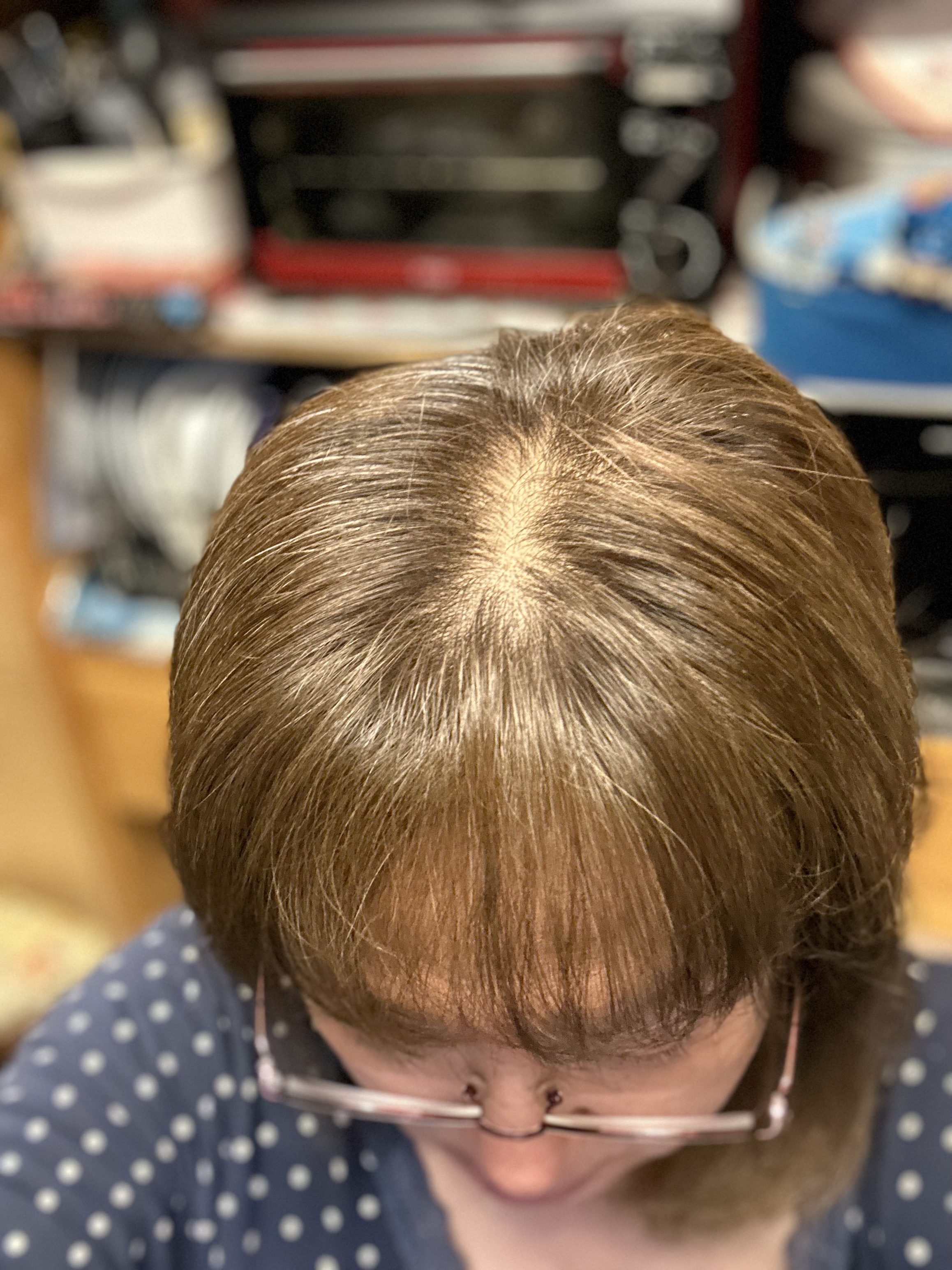 ヘアリッチローション/リソウコーポレーション/頭皮ローションを使ったクチコミ（3枚目）