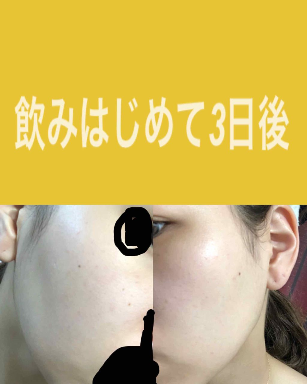 DHC ビタミンＣハードカプセル/DHC/美容サプリメントを使ったクチコミ（2枚目）