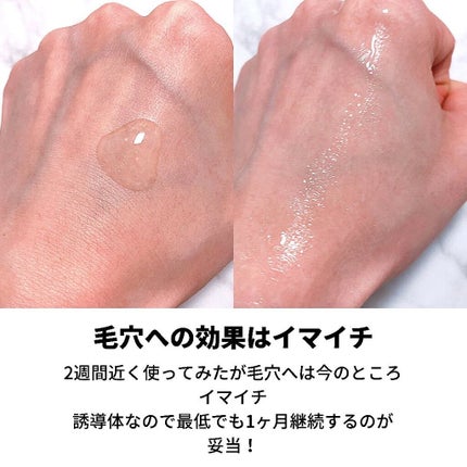 フォーカスCセラム/iskinclock/美容液を使ったクチコミ(4枚目)