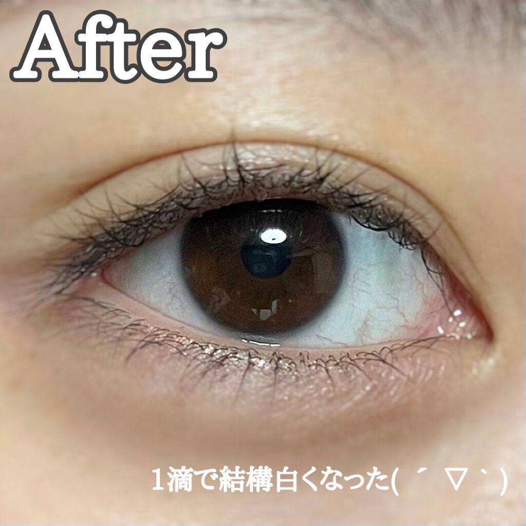 サンテ ボーティエ(医薬品)/参天製薬/その他を使ったクチコミ(3枚目)