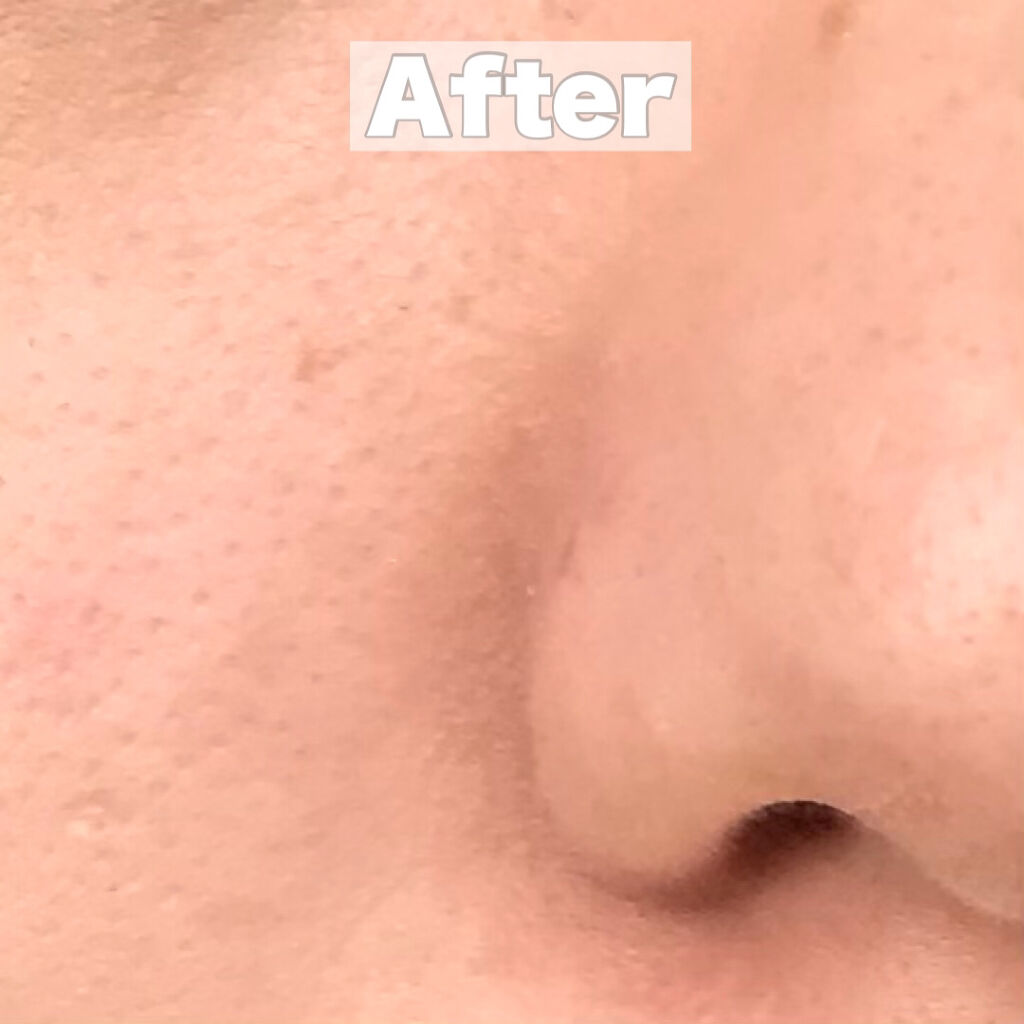 エリクシール ルフレ バランシング おしろいミルク Ｃ/エリクシール/乳液を使ったクチコミ（3枚目）