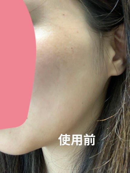 Wエッセンス/shimaboshi/美容液を使ったクチコミ(3枚目)