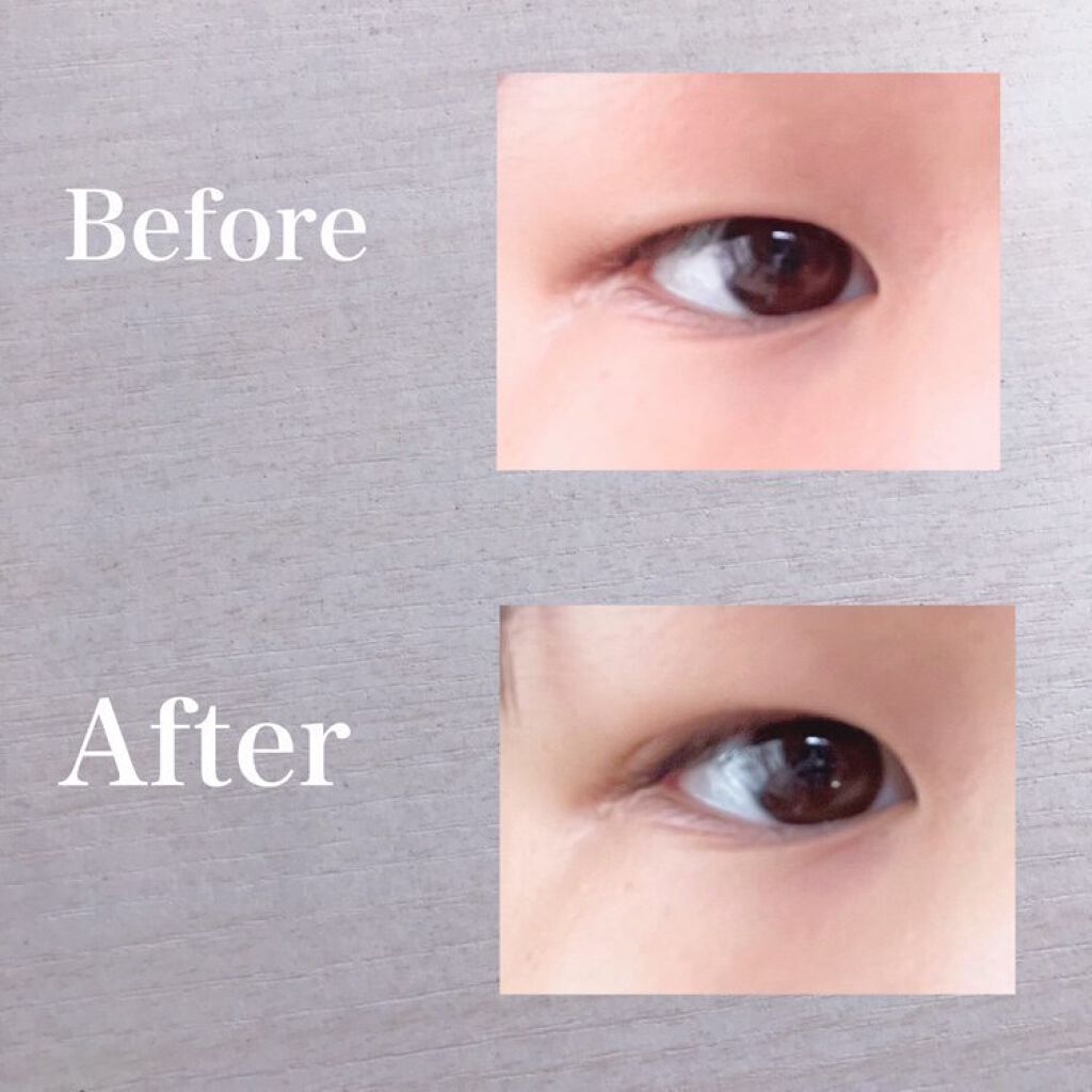 アイトーク/アイトーク/二重まぶた用アイテムを使ったクチコミ（2枚目）