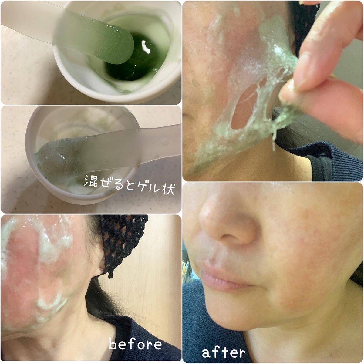 ニードル炭酸パック/NNE/洗い流すパック・マスクを使ったクチコミ（2枚目）