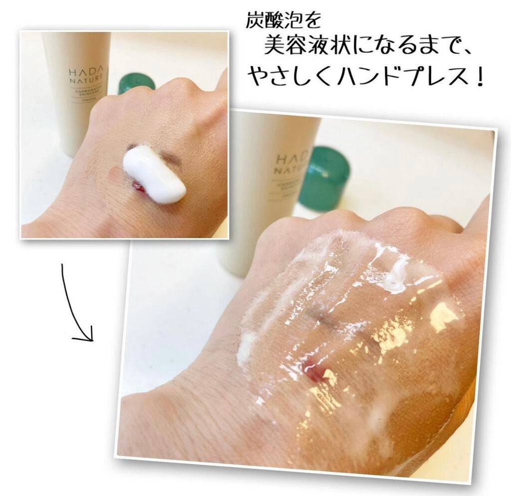 炭酸クレンジング/肌ナチュール/泡洗顔を使ったクチコミ(2枚目)