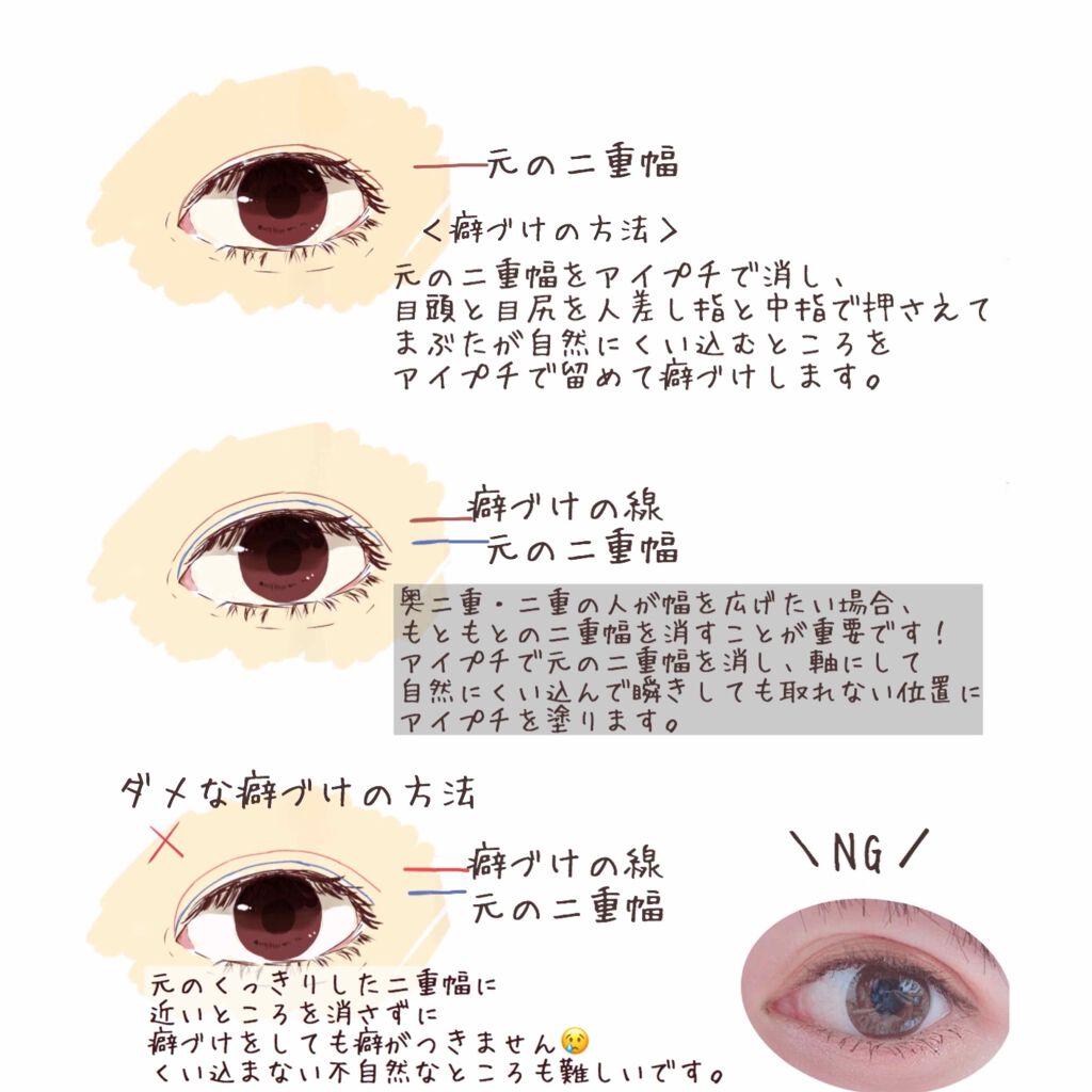 ナイトアイボーテ/StreeTrend/二重まぶた用アイテムを使ったクチコミ（2枚目）