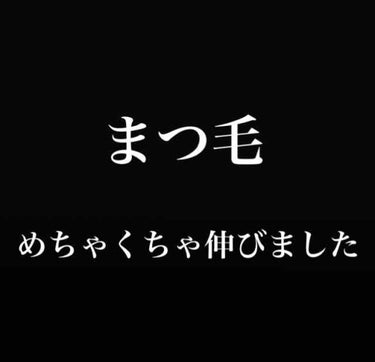 【まつ毛伸びました】

みなさん聞いてください。
まつ毛が伸びたんです！！！！

━━━━━━━━━━━━━━━

スカルプD   ボーテ  ピュアフリーアイラッシュセラム

1762円(店舗により異な